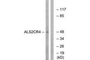 Western blot analysis of extracts from Jurkat cells, using ALS2CR4 Antibody. (TMEM237 anticorps  (AA 181-230))
