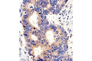 Immunohistochemical analysis of paraffin-embedded H. (PCSK9 anticorps  (C-Term))
