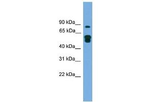 WB Suggested Anti-KIAA1609 Antibody Titration: 0. (KIAA1609 anticorps  (N-Term))