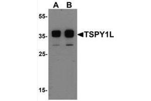 Western blot analysis of TSPY1L in A20 cell lysate with TSPY1L Antibody   at (A) 0.