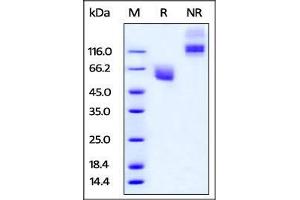 Cynomolgus CD47, Fc Tag on SDS-PAGE under reducing (R) and no-reducing (NR) conditions.