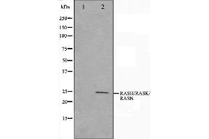 Western blot analysis on HeLa cell lysate using RASH/RASK/RASN Antibody,The lane on the left is treated with the antigen-specific peptide. (RASH/RASK/RASN anticorps)