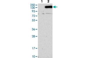 Western blot analysis of Lane 1: Negative control (vector only transfected HEK293T lysate). (NCKAP1 anticorps)