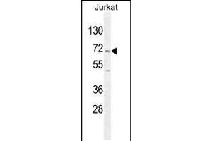 Western blot analysis in Jurkat cell line lysates (35ug/lane). (GAD65 anticorps  (AA 109-138))