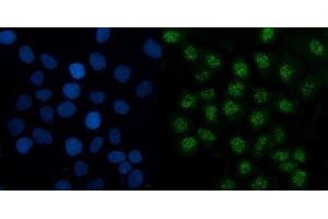 IF analysis of TMED5/p28 using anti-TMED5/p28 antibody (ABIN7601339). (TMED5 anticorps  (AA 33-164))