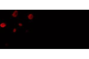 ABIN6274449 staining 293 cells by IF/ICC. (ORAOV1 anticorps  (Internal Region))