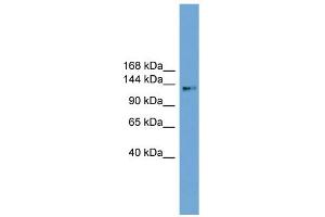 WB Suggested Anti-CCDC146 Antibody Titration: 0. (CCDC146 anticorps  (Middle Region))