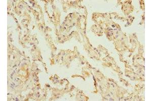 Immunohistochemistry of paraffin-embedded human lung tissue using ABIN7175319 at dilution of 1:100
