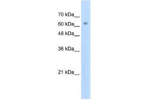 Human Jurkat; WB Suggested Anti-ZNF274 Antibody Titration: 2. (ZNF274 anticorps  (N-Term))
