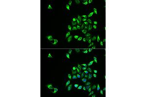 Immunofluorescence analysis of HeLa cells using CSNK1A1L antibody. (CSNK1A1L anticorps)