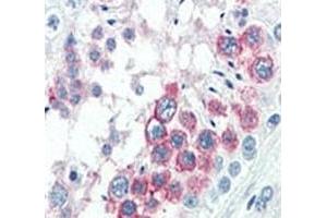 IHC analysis of FFPE human testis tissue stained with NANOG antibody