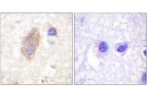 Immunohistochemistry (IHC) image for anti-Rabphilin 3A (RPH3A) (AA 203-252) antibody (ABIN2888698) (RPH3A anticorps  (AA 203-252))