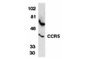 Western Blotting (WB) image for anti-Chemokine (C-C Motif) Receptor 5 (CCR5) (N-Term) antibody (ABIN1031308) (CCR5 anticorps  (N-Term))