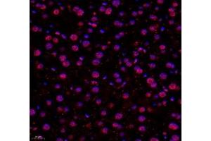 Immunofluorescence of paraffin embedded mouse liver using USP24 (ABIN7076111) at dilution of 1:650 (400x lens) (USP24 anticorps)