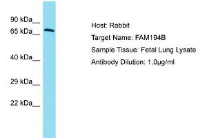 Host: Rabbit Target Name: FAM194B Sample Type: Fetal Lung lysates Antibody Dilution: 1. (FAM194B anticorps  (C-Term))