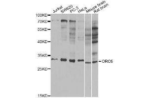 Western blot analysis of extracts of various cell lines, using ORC6 antibody (ABIN5973151) at 1/1000 dilution. (ORC6 anticorps)