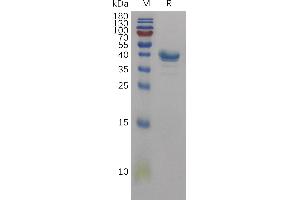 Human CD59 Protein, hFc Tag on SDS-PAGE under reducing condition.