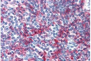 Human Tonsil: Formalin-Fixed, Paraffin-Embedded (FFPE) (MHC Class II DQ/DR anticorps (FITC))