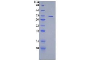SDS-PAGE analysis of Mouse Lymphotoxin beta Protein. (LTB Protéine)
