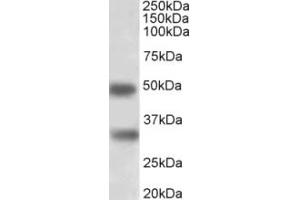 Western Blotting (WB) image for anti-GTP Binding Protein Overexpressed in Skeletal Muscle (GEM) (Internal Region) antibody (ABIN2465110) (GEM anticorps  (Internal Region))