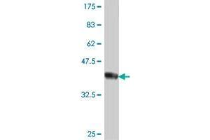 Western Blot detection against Immunogen (37.