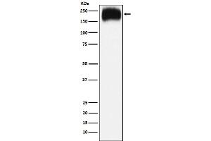 Western blot analysis of Niemann Pick C1 expression in HepG2 cell lysate.