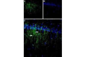 Expression of CaSR in rat brain - Immunohistochemical staining of rat hippocampal CA1 region using Anti-Calcium Sensing Receptor (extracellular) Antibody (ABIN7043018, ABIN7044161 and ABIN7044162). (CASR anticorps  (Extracellular, N-Term))