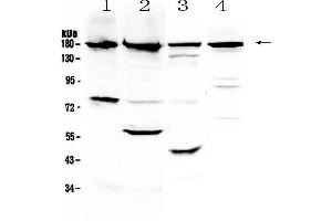 Western blot analysis of ErbB 4 using anti-ErbB 4 antibody . (ERBB4 anticorps)