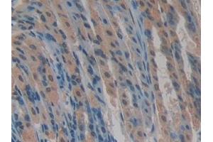 Detection of CYR61 in Mouse Stomach Tissue using Polyclonal Antibody to Cysteine Rich Protein, Angiogenic Inducer 61 (CYR61)