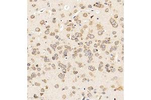 Immunohistochemistry of paraffin embedded mouse brain using LEG8 (ABIN7074474) at dilution of 1:1000 (300x lens) (LGALS8 anticorps)