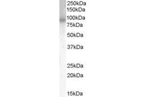 ABIN185574 (0. (PDE4B anticorps  (C-Term))