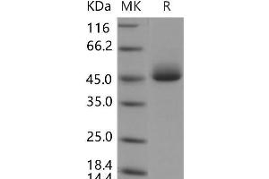 Western Blotting (WB) image for Acid Phosphatase, Prostate (ACPP) protein (His tag) (ABIN7320069)