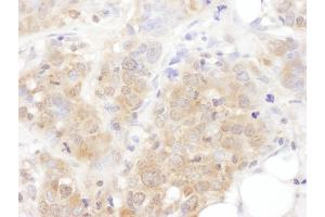 Immunohistochemistry (IHC) image for anti-TBC1 Domain Family, Member 4 (TBC1D4) (AA 200-250) antibody (ABIN7454955)