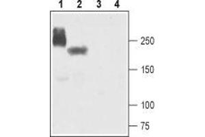 Western blot analysis of human-NaV1. (SCN5A anticorps  (Intracellular))
