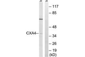 Western blot analysis of extracts from Jurkat cells, using GJA4 Antibody. (GJA4 anticorps  (AA 81-130))