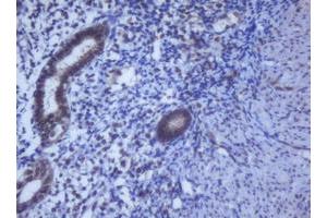 Image no. 11 for anti-DEAD (Asp-Glu-Ala-Asp) Box Polypeptide 59 (DDX59) (AA 1-303) antibody (ABIN1490728) (DDX59 anticorps  (AA 1-303))