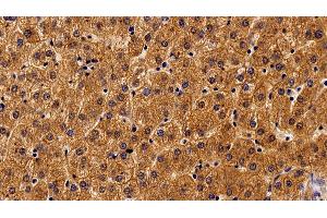 Detection of ALCAM in Human Liver Tissue using Monoclonal Antibody to Activated Leukocyte Cell Adhesion Molecule (ALCAM) (CD166 anticorps  (AA 28-527))