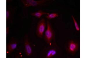 Immunofluorescence staining of methanol-fixed Hela cells using ATF2(Phospho-Thr69 or 51) Antibody. (ATF2 anticorps  (pThr69))