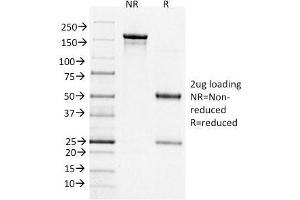 SDS-PAGE Analysis Purified BCL-6 Mouse Monoclonal Antibody (BCL6/1526). (BCL6 anticorps  (AA 256-389))