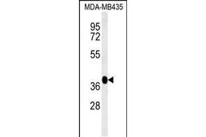 Western blot analysis in MDA-MB435 cell line lysates (35ug/lane). (FBXL14 anticorps  (C-Term))