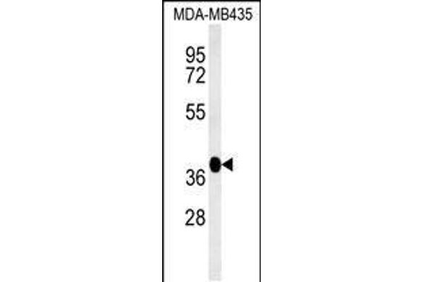 FBXL14 anticorps  (C-Term)