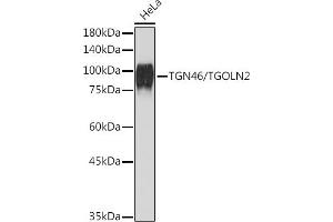 Western blot analysis of extracts of HeLa cells, using TGN46/TGOLN2 Rabbit mAb (ABIN7270875) at 1:1000 dilution. (TGOLN2 anticorps)