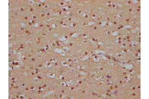 IHC image of ABIN7127821 diluted at 1:100 and staining in paraffin-embedded human brain tissue performed on a Leica BondTM system. (Recombinant SOX1 anticorps)