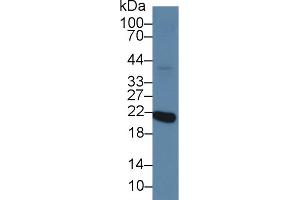 Western Blot; Sample: Mouse Eye lysate; Primary Ab: 2µg/ml Rabbit Anti-Human RCVRN Antibody Second Ab: 0.