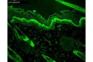 Immunohistochemistry analysis using Mouse Anti-Hsp27 Monoclonal Antibody, Clone 8A7 (ABIN361755 and ABIN361756).