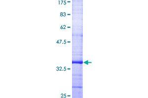 Image no. 1 for Gap Junction Protein, beta 1, 32kDa (GJB1) (AA 75-174) protein (GST tag) (ABIN1355139)