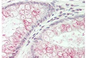 Rabbit Anti-WNK3 antibody  Formalin Fixed Paraffin Embedded Tissue: Human Colon Primary antibody Concentration: 1:100 Secondary Antibody: Donkey anti-Rabbit-Cy3 Secondary Antibody Concentration: 1:200 Magnification: 20x Exposure Time: 0.