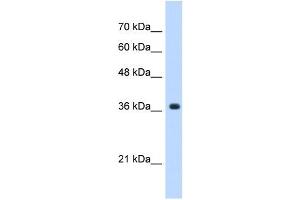 A4GNT antibody used at 0. (A4GNT anticorps  (C-Term))