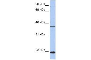 HDDC3 antibody used at 1 ug/ml to detect target protein. (HDDC3 anticorps  (Middle Region))