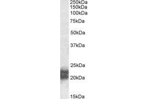 Western Blotting (WB) image for anti-Niemann-Pick Disease, Type C2 (NPC2) (AA 18-31) antibody (ABIN490668) (NPC2 anticorps  (AA 18-31))